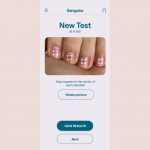 Hanya Foto Kuku Bisa Digunakan untuk Mendeteksi Penyakit Anemia