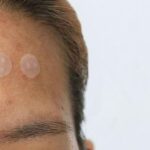 Jangan Asal Pakai, Kenali 13 Acne Patch Terbaik yang Efektif Menghilangkan Jerawat